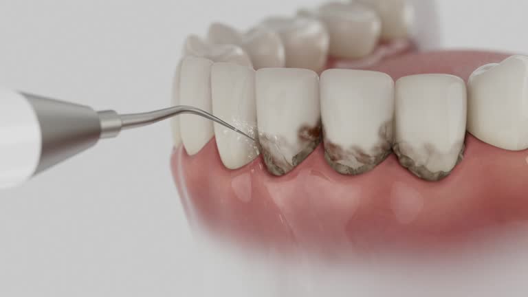 Trusted Teeth Whitening service in Mount Healthy Heights, OH - Dentist Open Now